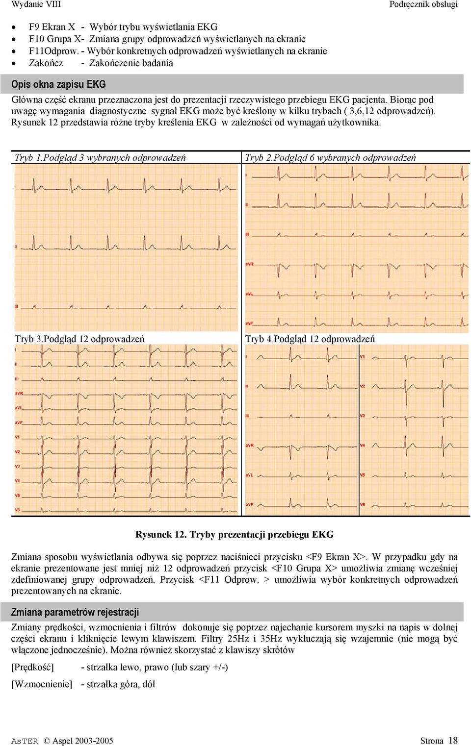 Biorąc pod uwagę wymagania diagnostyczne sygnał EKG może być kreślony w kilku trybach ( 3,6,12 odprowadzeń). Rysunek 12 przedstawia różne tryby kreślenia EKG w zależności od wymagań użytkownika.