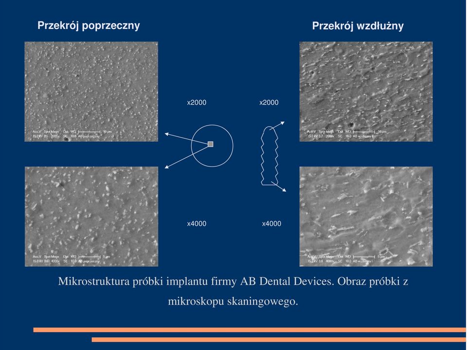 Jaki Obraz Powstaje W Skaningowym Mikroskopie Elektronowym Mikrostruktura wybranych implantów stomatologicznych w mikroskopie