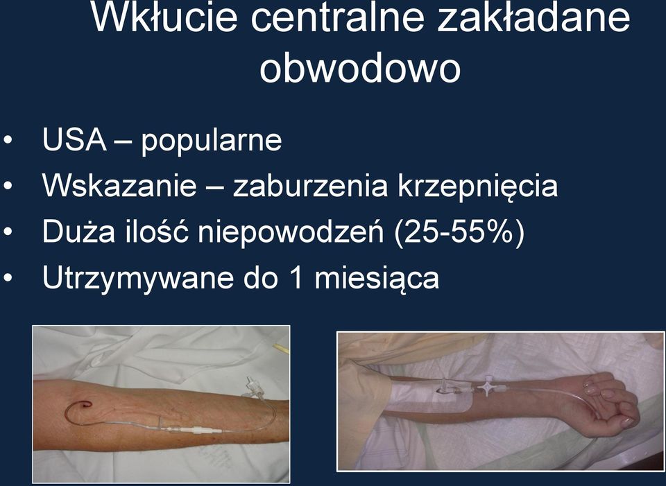 zaburzenia krzepnięcia Duża ilość