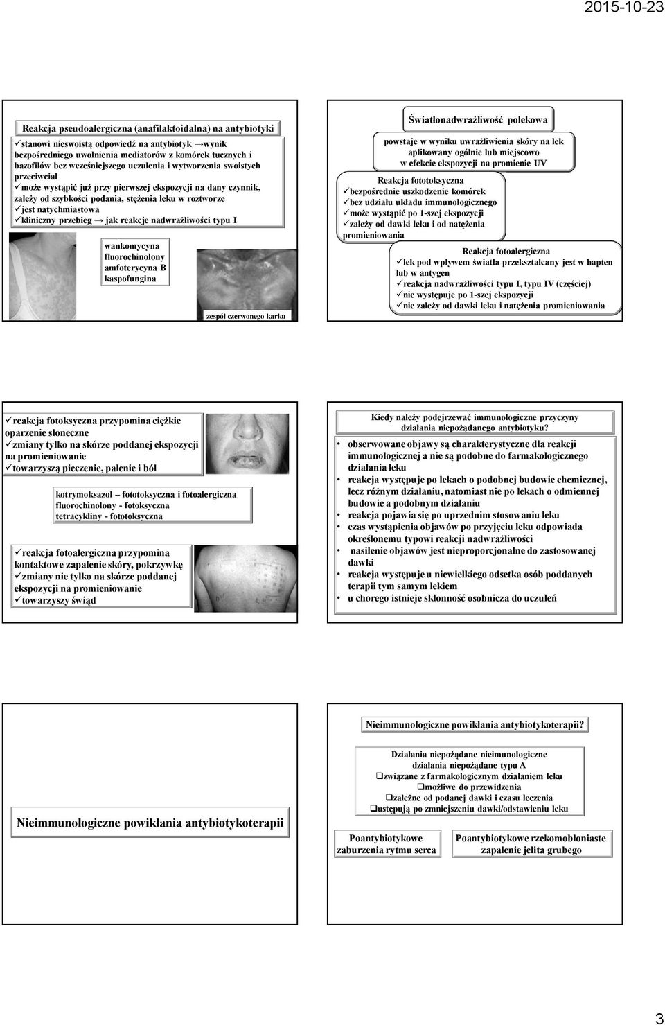 przebieg jak reakcje nadwrażliwości typu I wankomycyna fluorochinolony amfoterycyna B kaspofungina zespół czerwonego karku Światłonadwrażliwość polekowa powstaje w wyniku uwrażliwienia skóry na lek