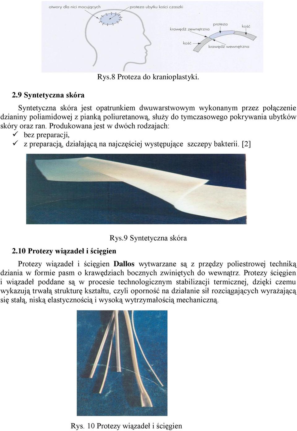 Produkowana jest w dwóch rodzajach: bez preparacji, z preparacją, działającą na najczęściej występujące szczepy bakterii. [2] 2.10 Protezy wiązadeł i ścięgien Rys.