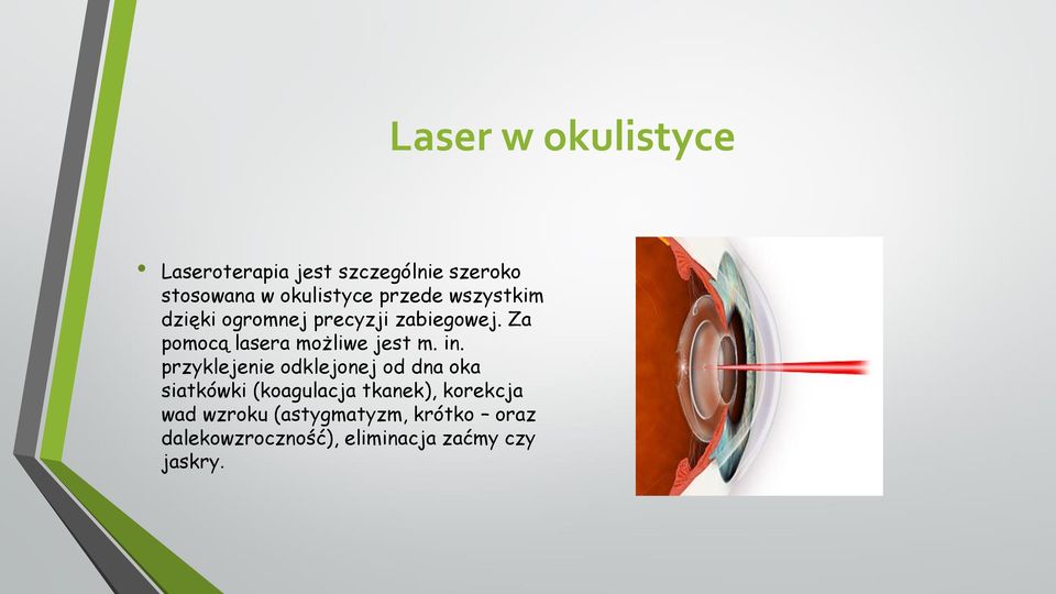 przyklejenie odklejonej od dna oka siatkówki (koagulacja tkanek), korekcja wad