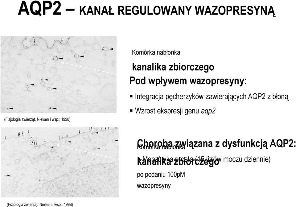 zawierających AQP2 z błoną Wzrost ekspresji genu aqp2 Choroba związana z dysfunkcją AQP2: Komórka