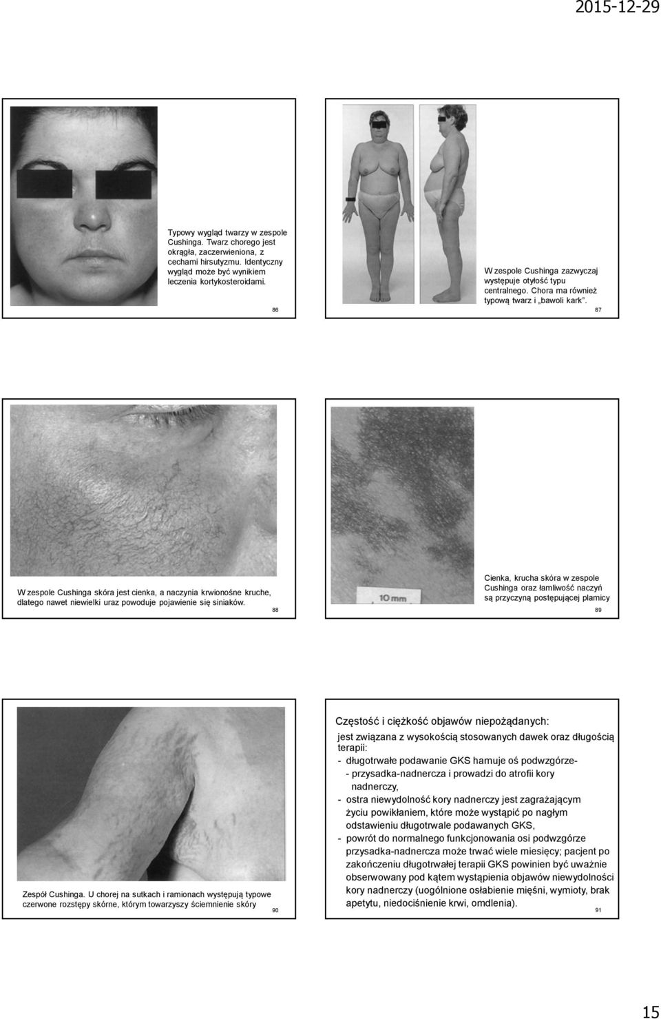 Hormonoterapia Układ Hormonalny Pod Względem Chemicznym Hormony