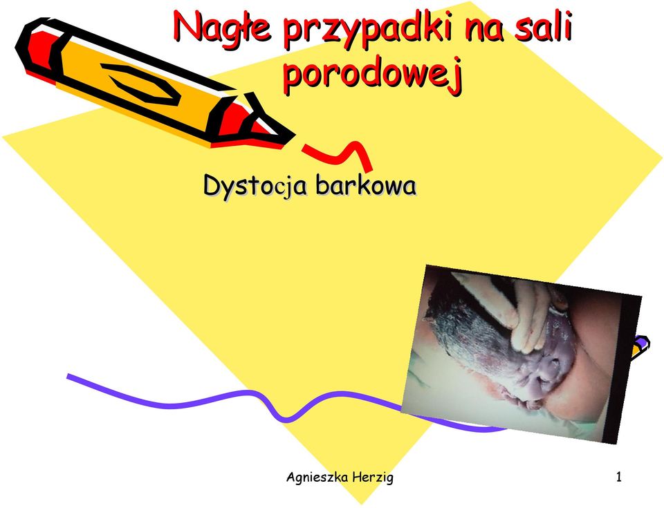 Dystocj cja a