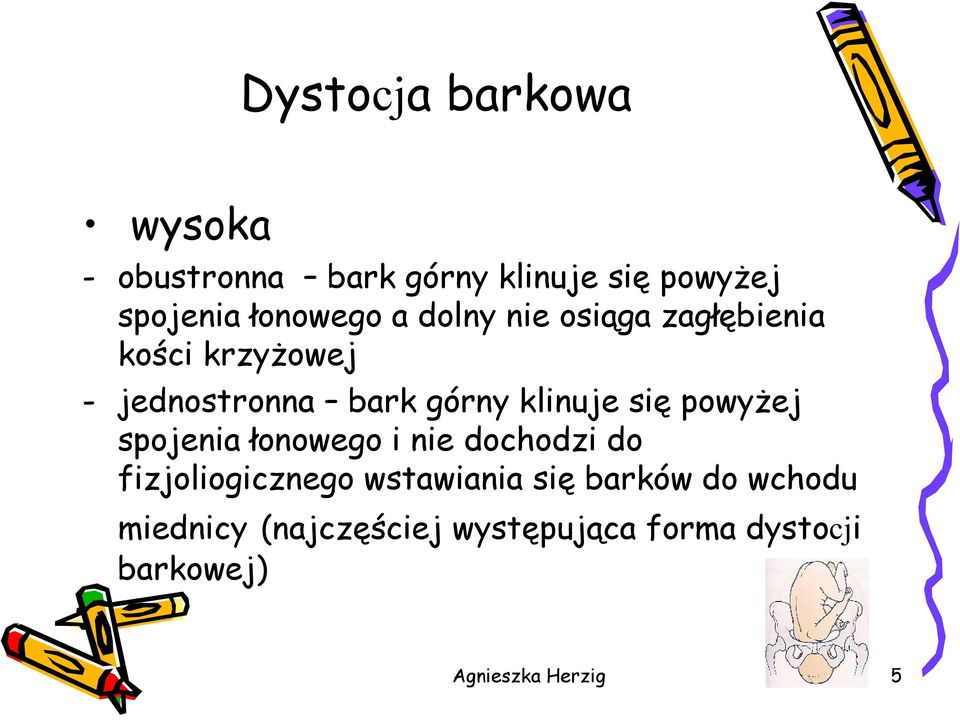 powyżej spojenia łonowego i nie dochodzi do fizjoliogicznego wstawiania się barków do