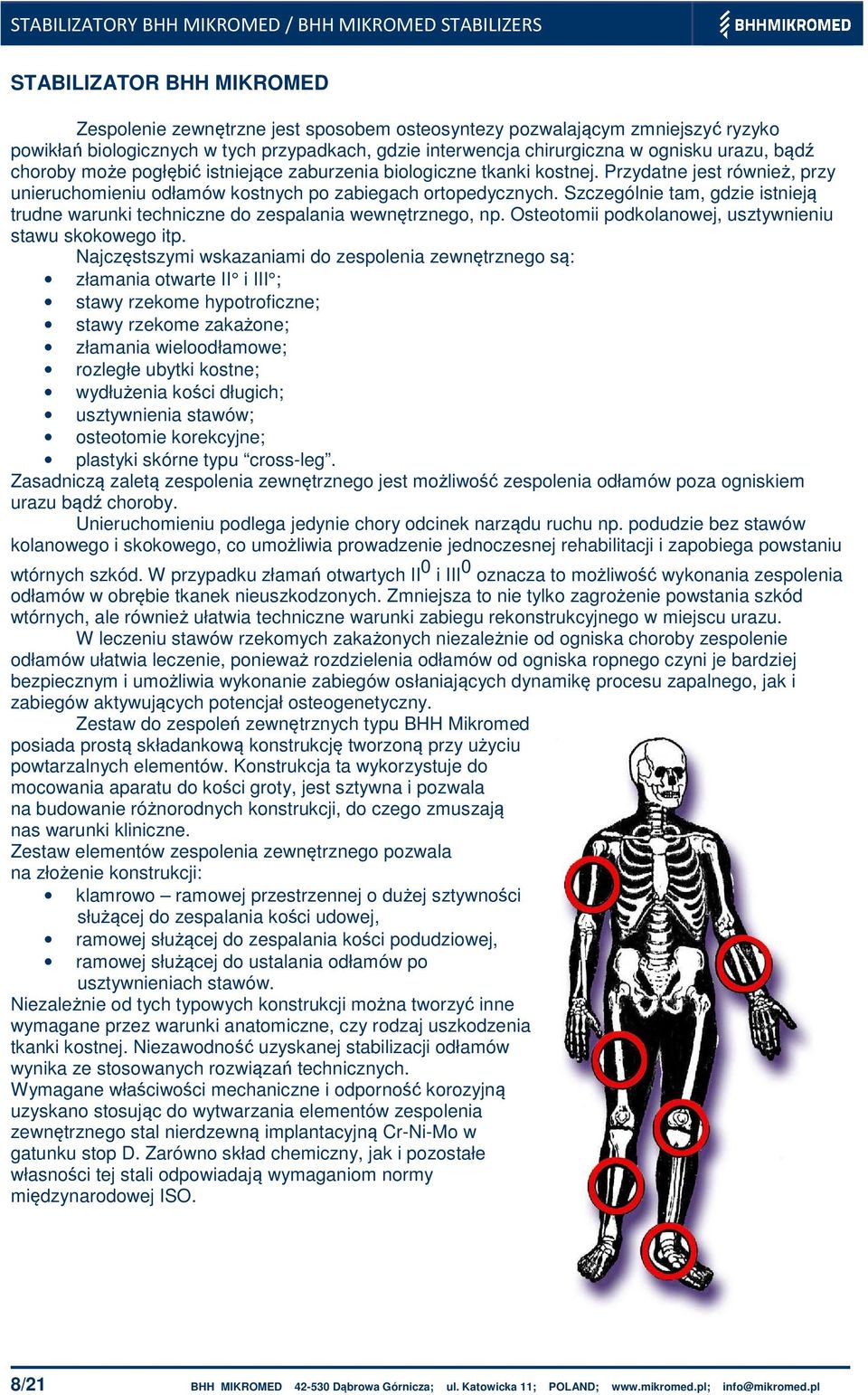 Szczególnie tam, gdzie istnieją trudne warunki techniczne do zespalania wewnętrznego, np. Osteotomii podkolanowej, usztywnieniu stawu skokowego itp.