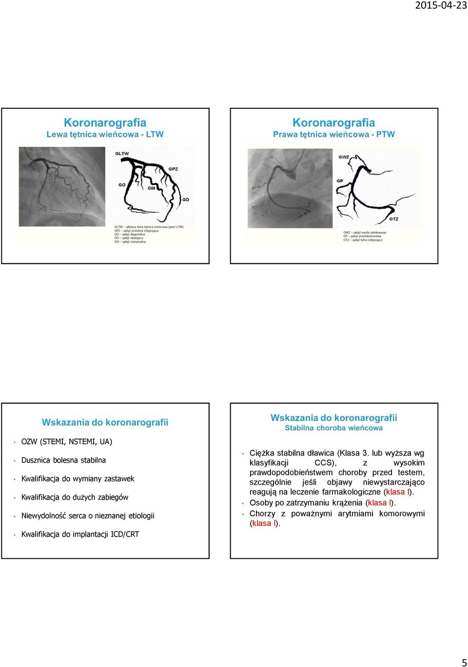 lub wyższa wg klasyfikacji CCS), z wysokim prawdopodobieństwem choroby przed testem, szczególnie jeśli objawy