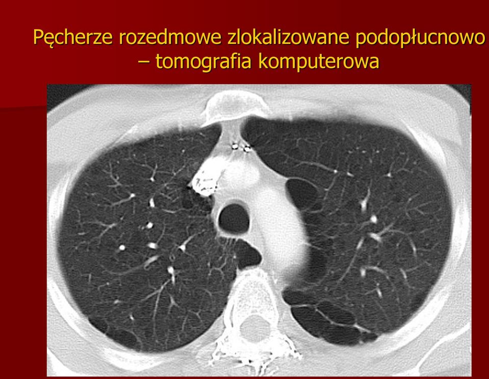 zlokalizowane