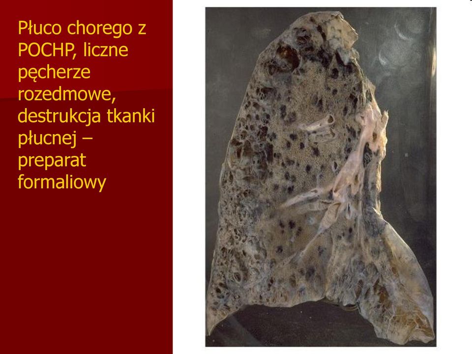 rozedmowe, destrukcja