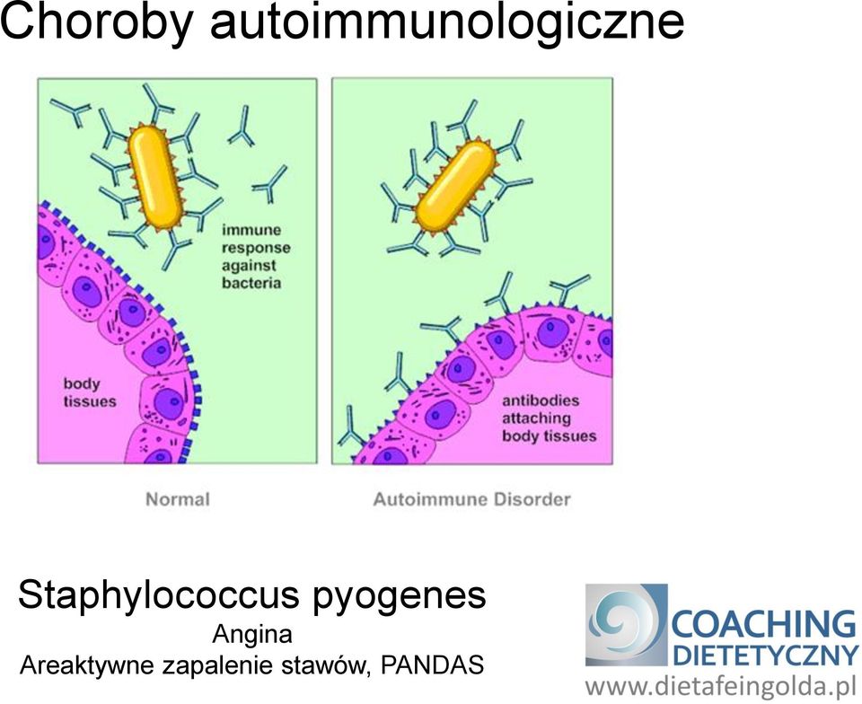 Staphylococcus pyogenes