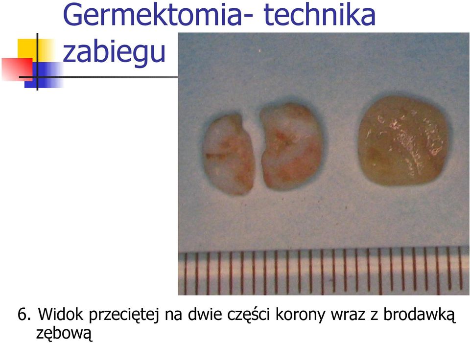 Widok przeciętej na