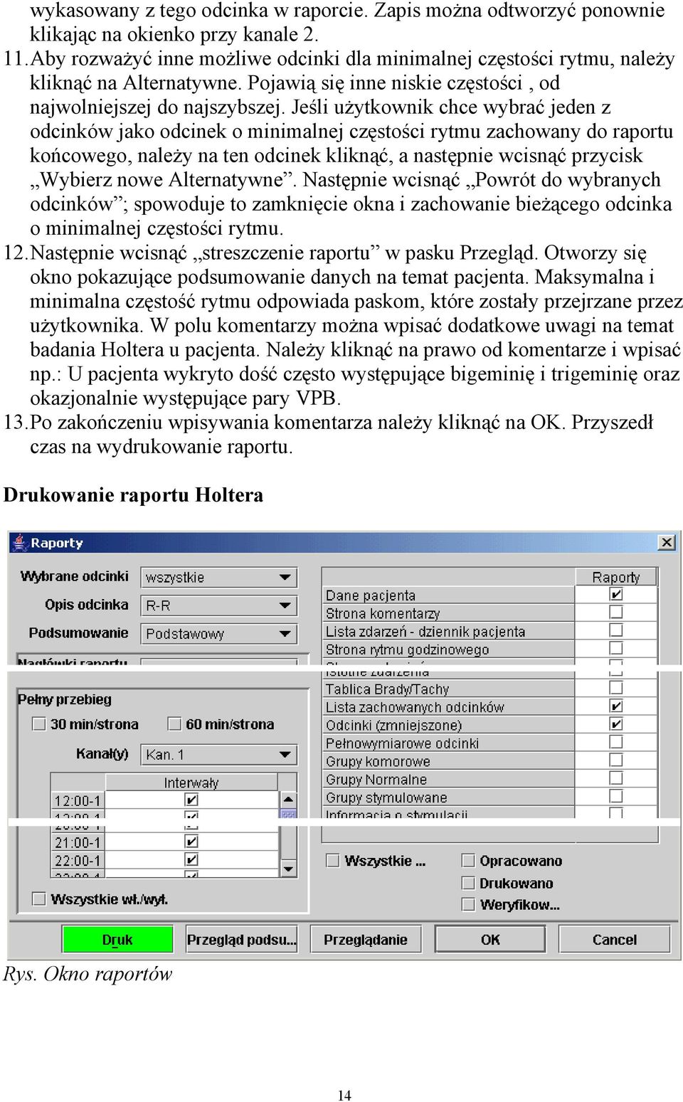 Jeśli użytkownik chce wybrać jeden z odcinków jako odcinek o minimalnej częstości rytmu zachowany do raportu końcowego, należy na ten odcinek kliknąć, a następnie wcisnąć przycisk Wybierz nowe