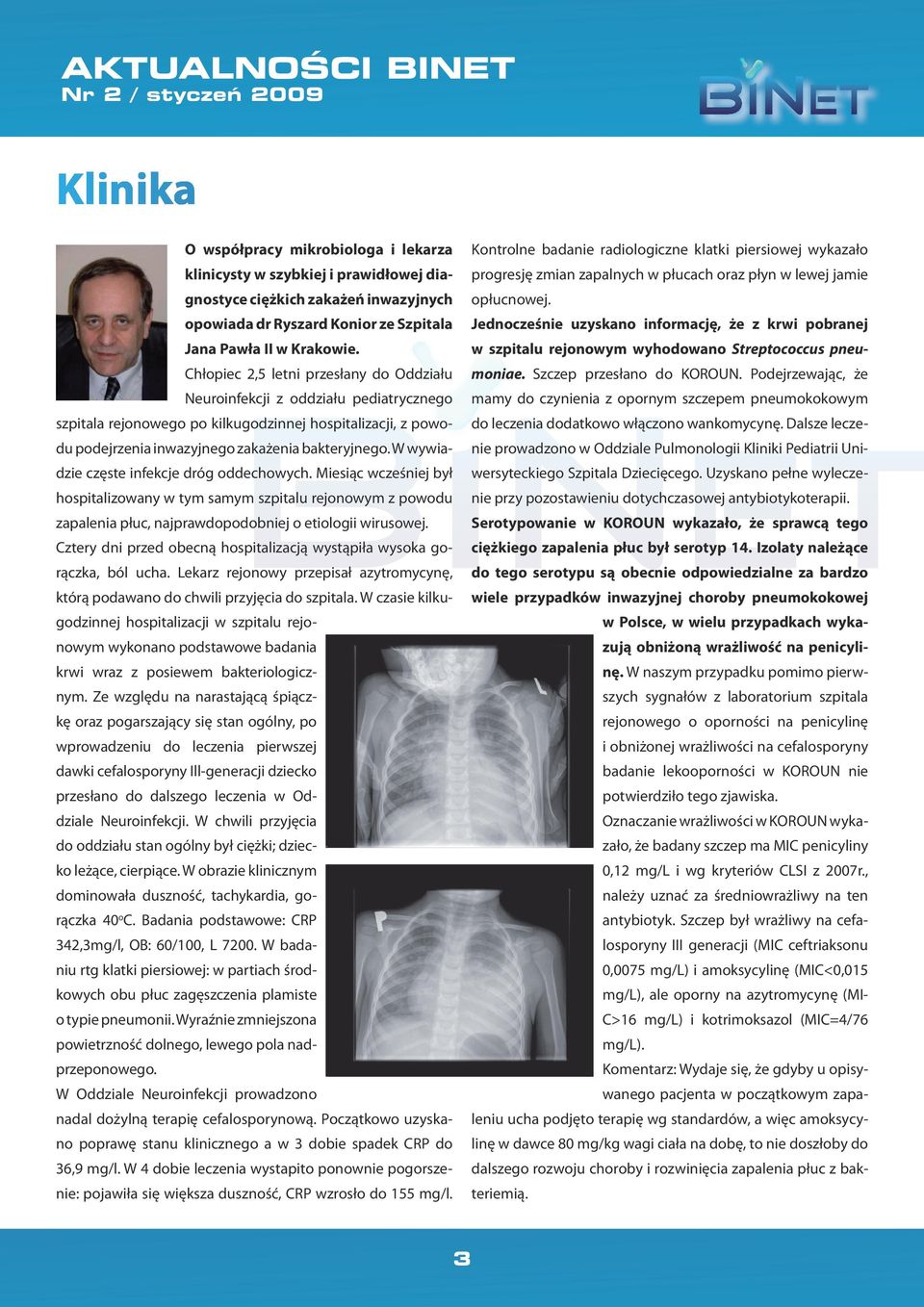 W wywiadzie częste infekcje dróg oddechowych. Miesiąc wcześniej był hospitalizowany w tym samym szpitalu rejonowym z powodu zapalenia płuc, najprawdopodobniej o etiologii wirusowej.