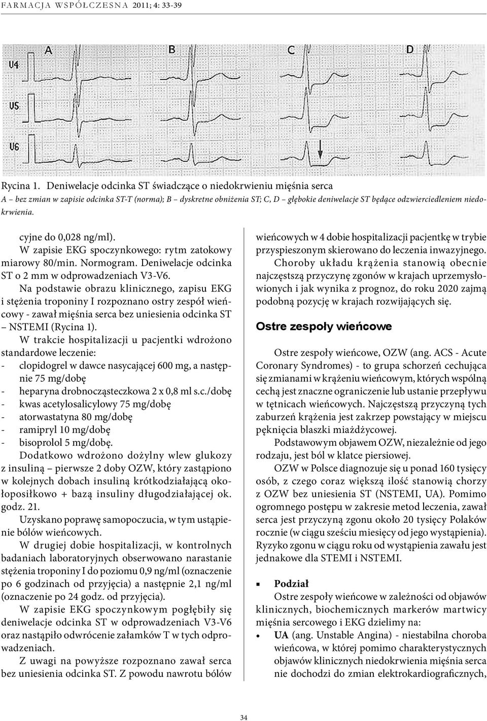 niedokrwienia. cyjne do 0,028 ng/ml). W zapisie EKG spoczynkowego: rytm zatokowy miarowy 80/min. Normogram. Deniwelacje odcinka ST o 2 mm w odprowadzeniach V3-V6.