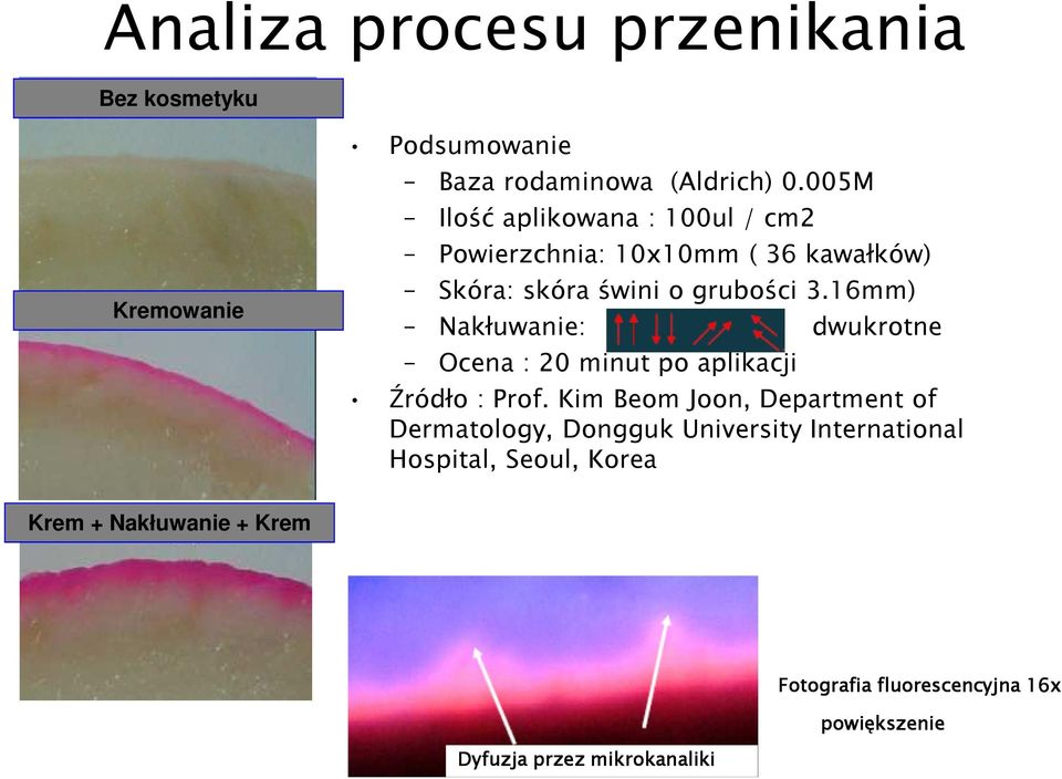 16mm) Nakłuwanie: dwukrotne Ocena : 20 minut po aplikacji Źródło : Prof.