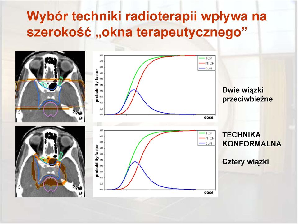 terapeutycznego Dwie wiązki