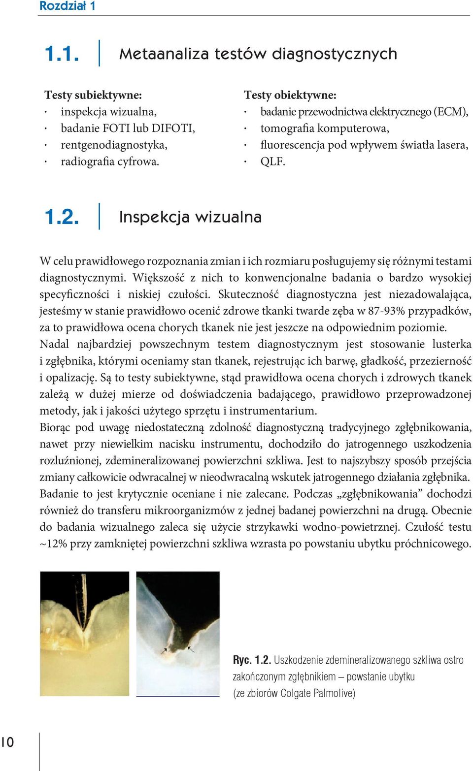 rentgenodiagnostyka, fluorescencja pod wpływem światła lasera, radiografia cyfrowa. QLF. 1.2.