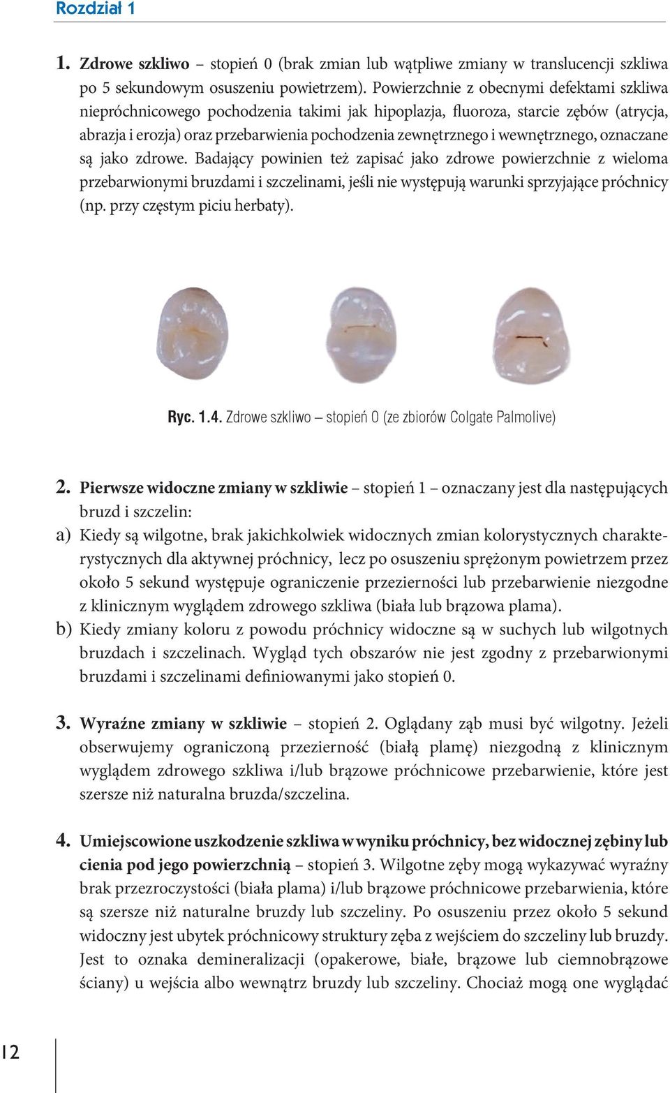 wewnętrznego, oznaczane są jako zdrowe. Badający powinien też zapisać jako zdrowe powierzchnie z wieloma przebarwionymi bruzdami i szczelinami, jeśli nie występują warunki sprzyjające próchnicy (np.
