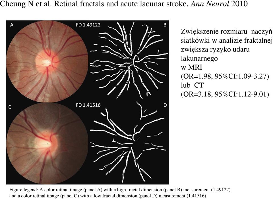 w MRI (OR=1.98, 95%CI:1.09-3.27) lub CT (OR=3.18, 95%CI:1.12-9.