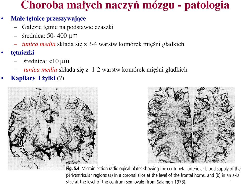 składa się z 3-4 warstw komórek mięśni gładkich tętniczki średnica: <10