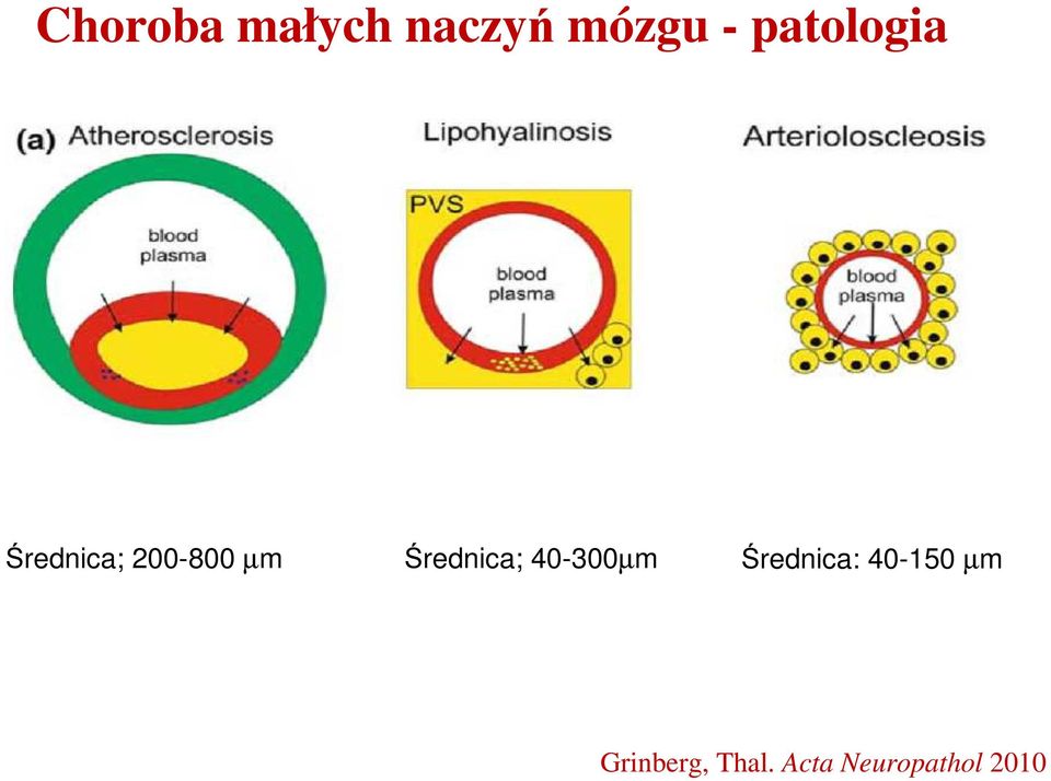 Średnica; 40-300µm Średnica: