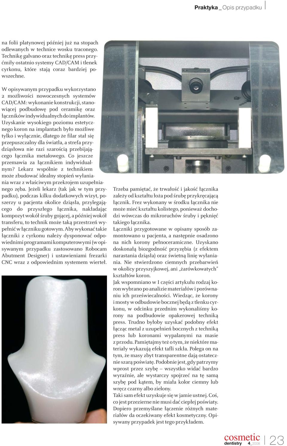 W opisywanym przypadku wykorzystano 2 możliwości nowoczesnych systemów CAD/CAM: wykonanie konstrukcji, stanowiącej podbudowę pod ceramikę oraz łączników indywidualnych do implantów.