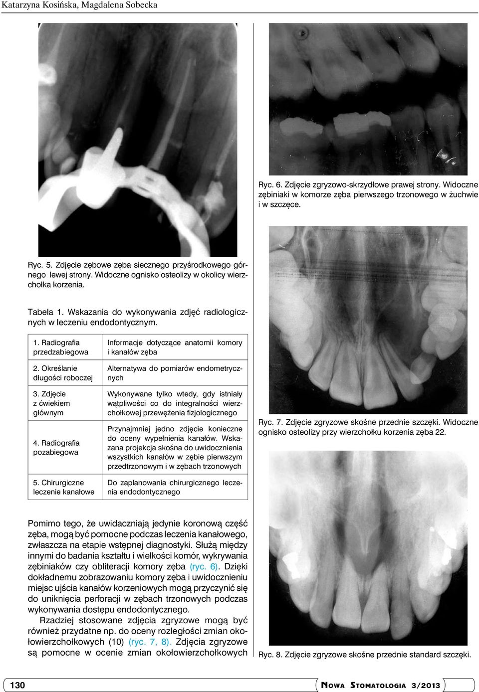 Wskazania do wykonywania zdjęć radiologicznych w leczeniu endodontycznym. 1. Radiografia przedzabiegowa 2. Określanie długości roboczej 3. Zdjęcie z ćwiekiem głównym 4. Radiografia pozabiegowa 5.