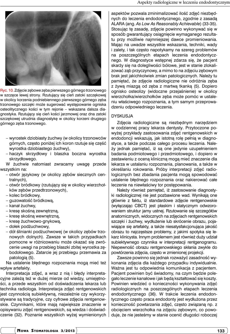 dalsza diagnostyka. Rzutujący się cień kości jarzmowej oraz dna zatoki szczękowej utrudnia diagnostykę w okolicy korzeni drugiego górnego zęba trzonowego.