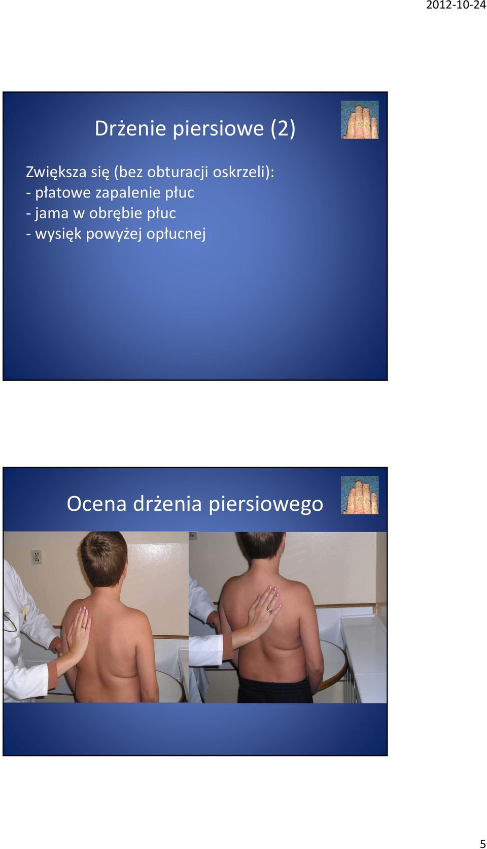 płuc -jama w obrębie płuc - wysięk