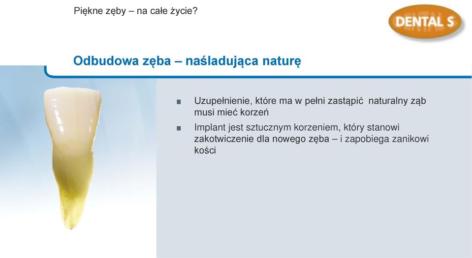 pełni zastąpić naturalny ząb musi mieć korzeń Implant jest