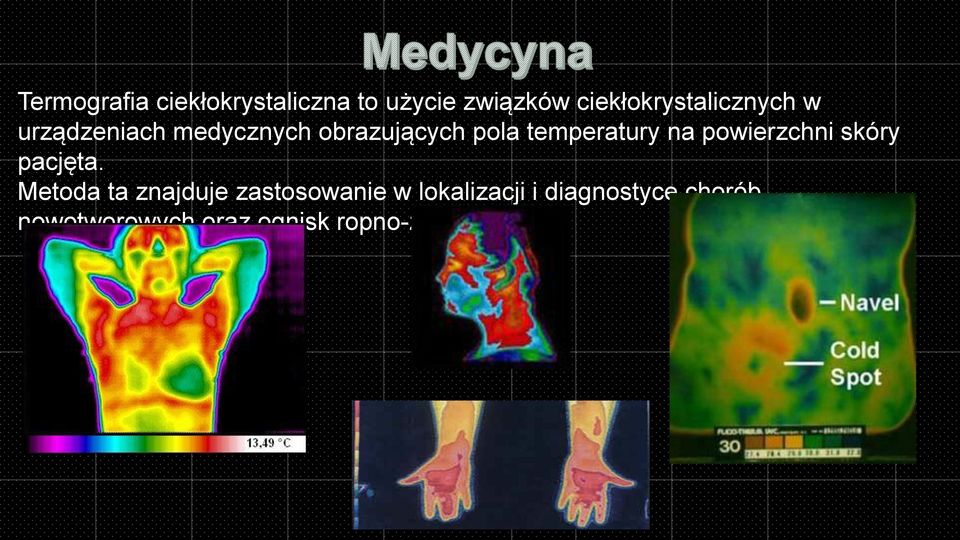 temperatury na powierzchni skóry pacjęta.