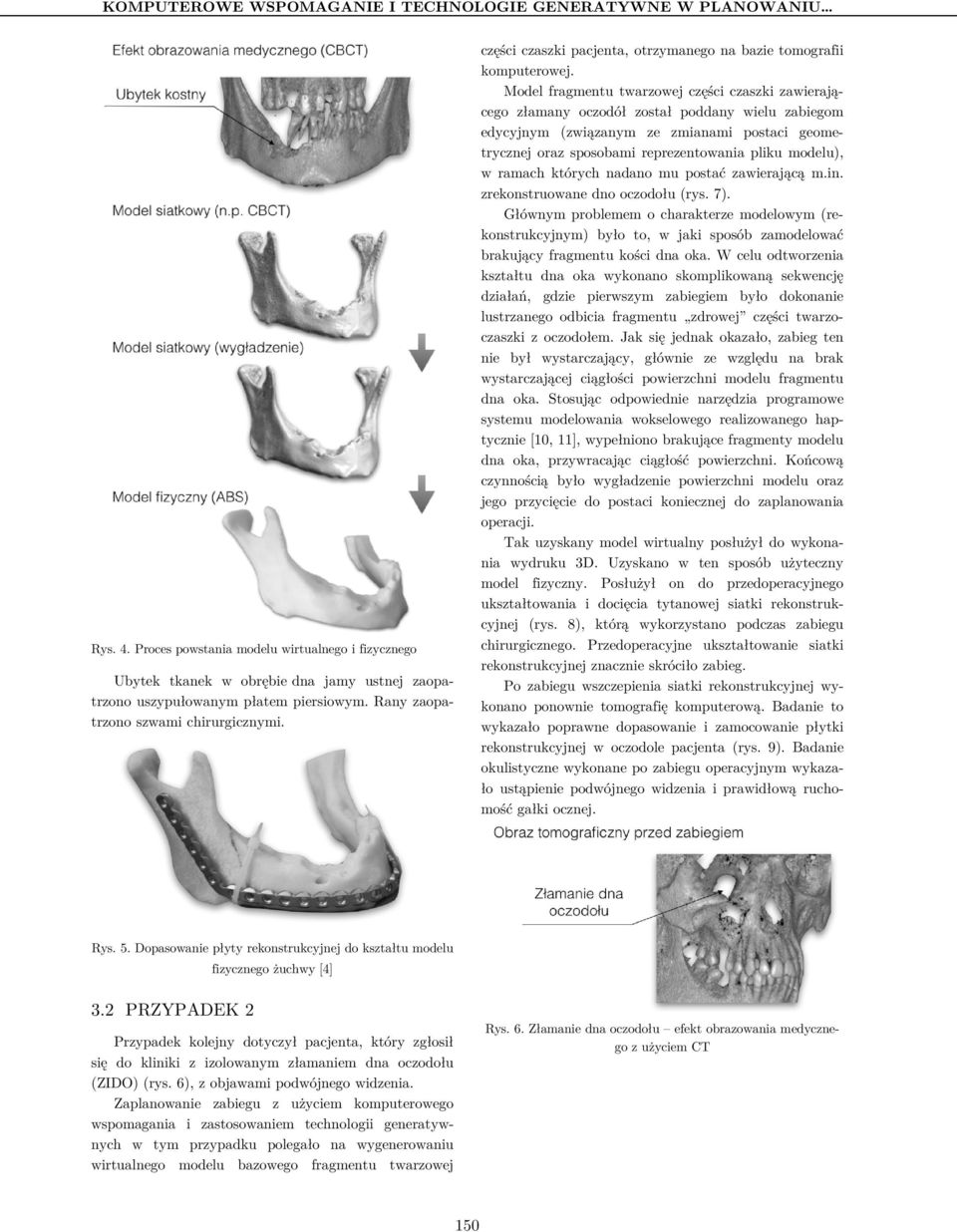 części czaszki pacjenta, otrzymanego na bazie tomografii komputerowej.