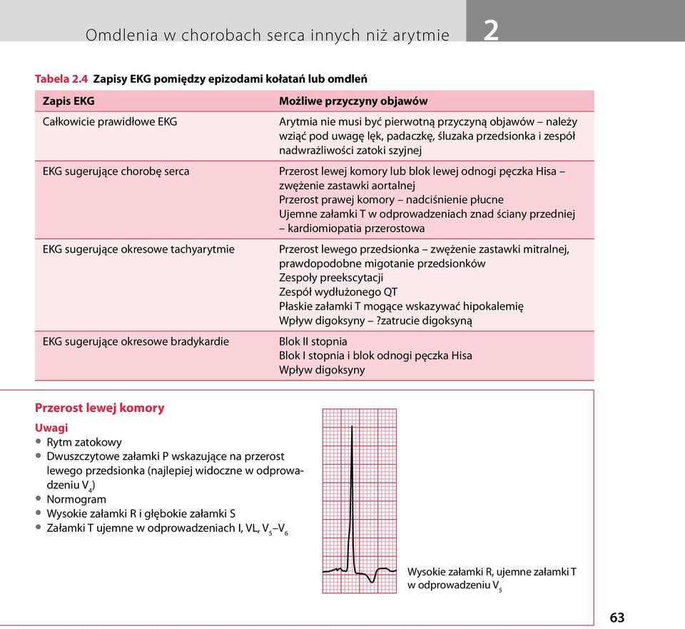 śluzaka przedsionka i zespół nadwrażliwości zatoki szyjnej EKG sugerujące chorobę serca Przerost lewej komory lub blok lewej odnogi pęczka Hisa zwężenie zastawki aortalnej Przerost prawej komory