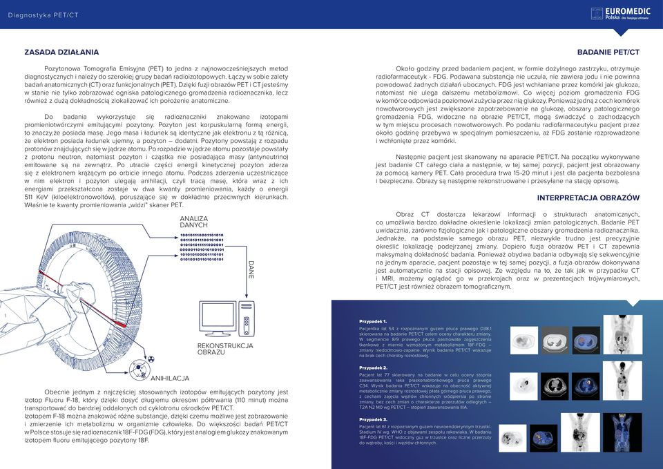 Dzięki fuzji obrazów PET i CT jesteśmy w stanie nie tylko zobrazować ogniska patologicznego gromadzenia radioznacznika, lecz również z dużą dokładnością zlokalizować ich położenie anatomiczne.
