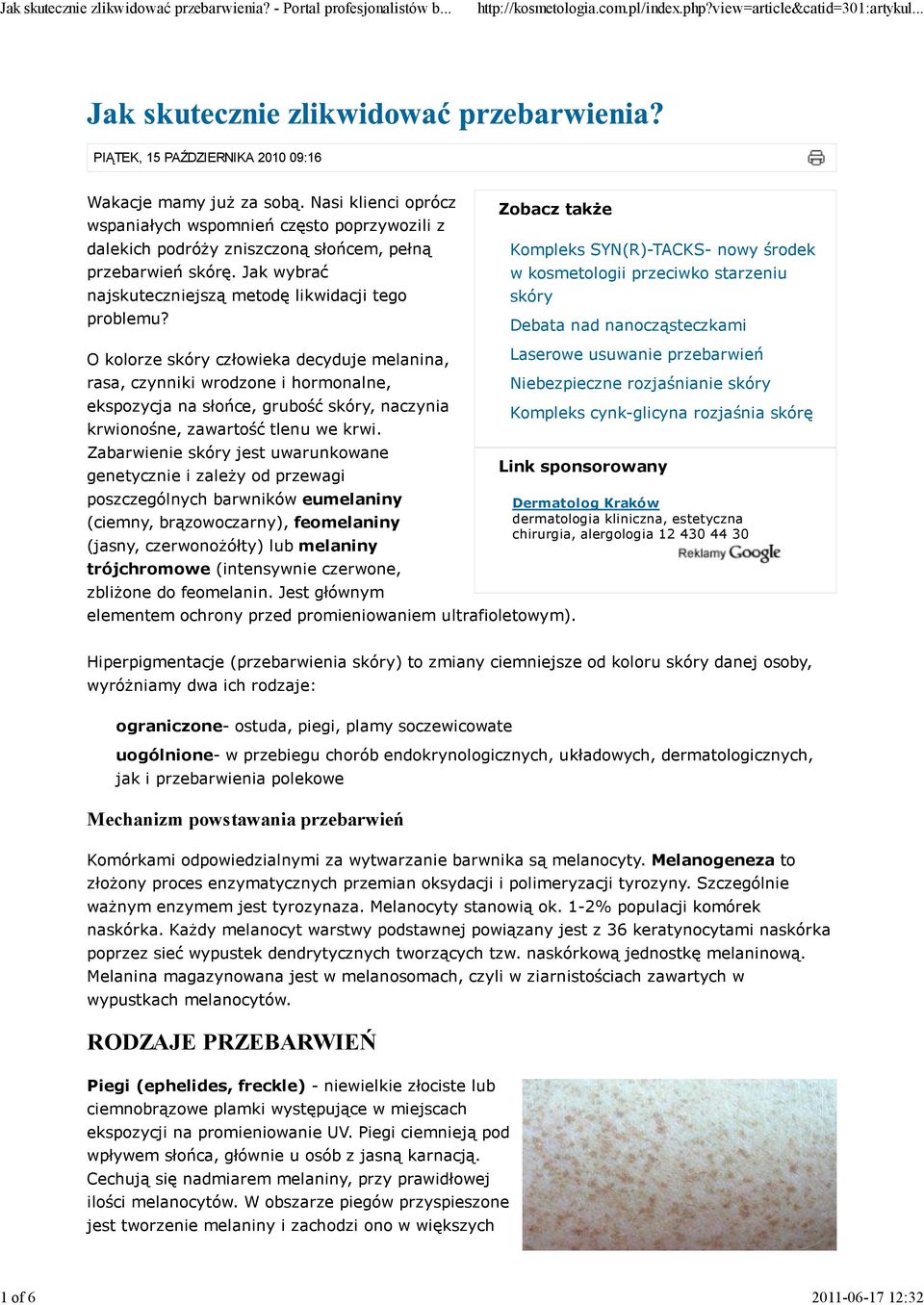 Zobacz także Kompleks SYN(R)-TACKS- nowy środek w kosmetologii przeciwko starzeniu skóry Debata nad nanocząsteczkami O kolorze skóry człowieka decyduje melanina, Laserowe usuwanie przebarwień rasa,