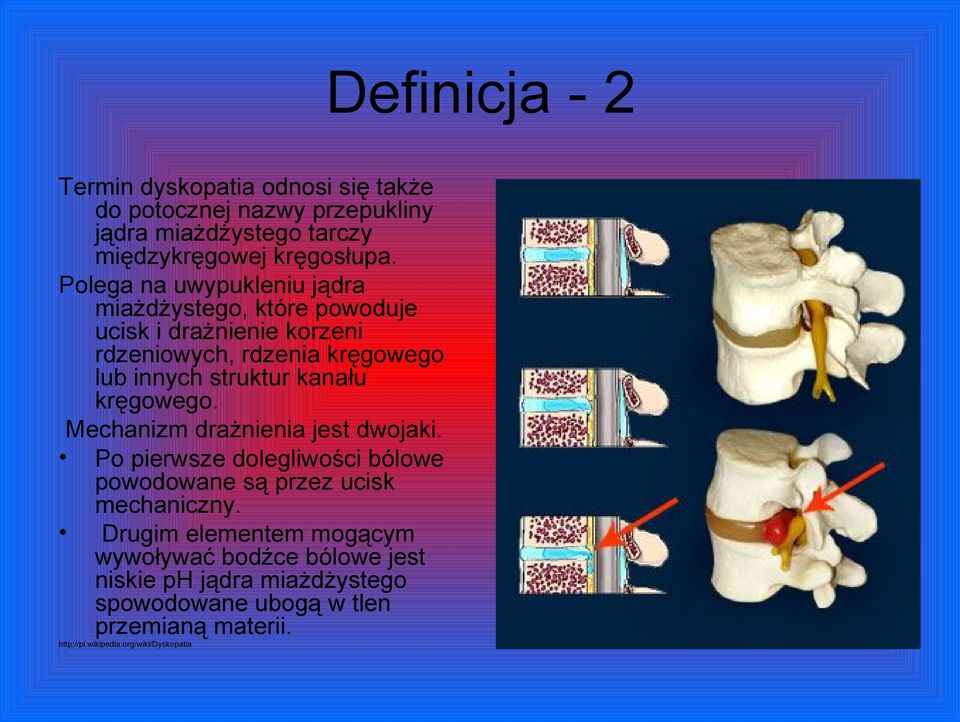kanału kręgowego. Mechanizm drażnienia jest dwojaki. Po pierwsze dolegliwości bólowe powodowane są przez ucisk mechaniczny.