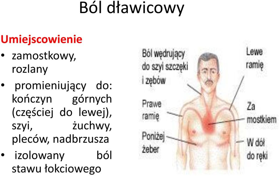 (częściej do lewej), szyi, żuchwy,