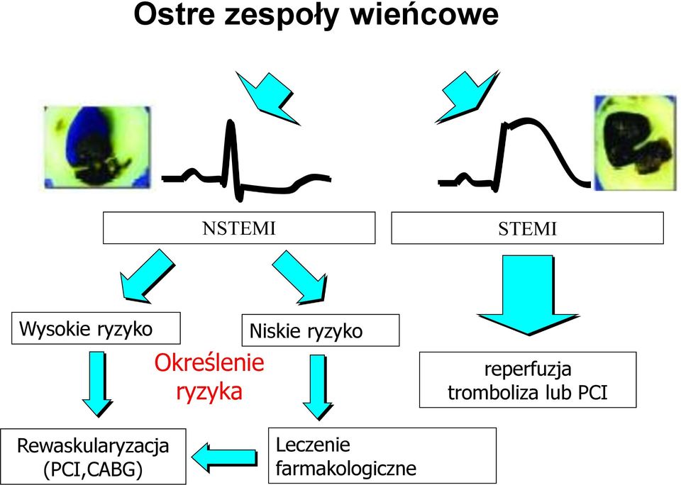 ryzyko reperfuzja tromboliza lub PCI