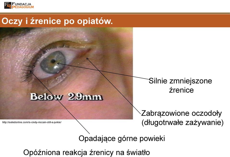 com/is-cindy-mccain-still-a-junkie/ Zabrązowione