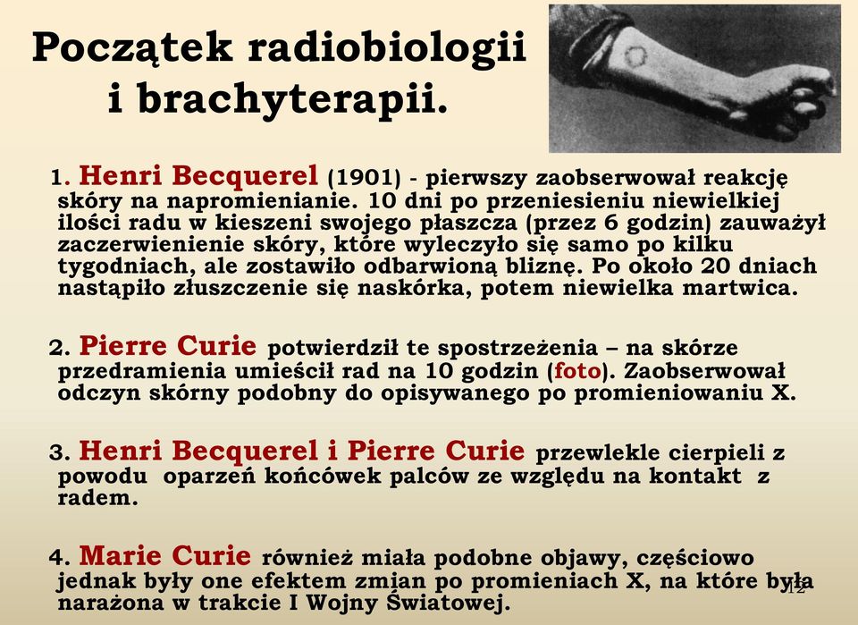 bliznę. Po około 20 dniach nastąpiło złuszczenie się naskórka, potem niewielka martwica. 2. Pierre Curie potwierdził te spostrzeżenia na skórze przedramienia umieścił rad na 10 godzin (foto).