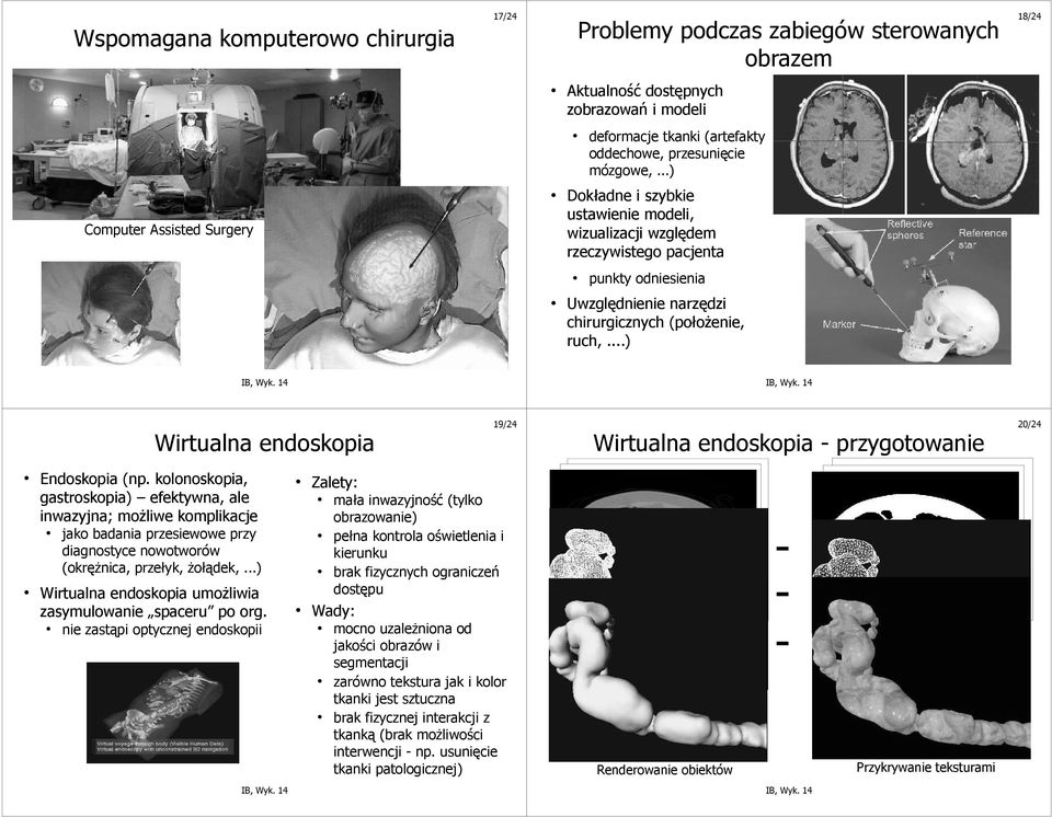 ..) Wirtualna endoskopia 19/24 Wirtualna endoskopia - przygotowanie 20/24 Endoskopia (np.