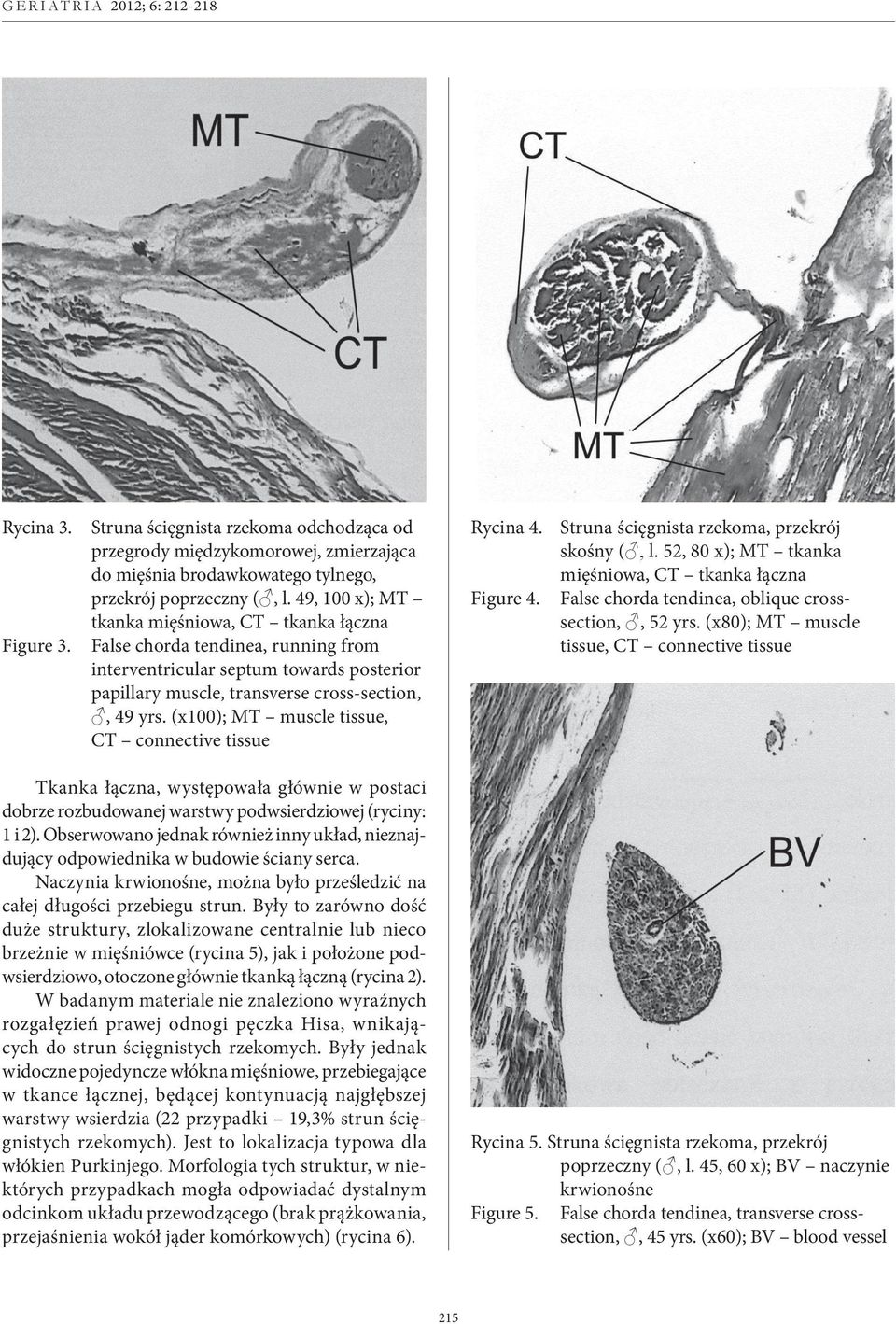 (x100); MT muscle tissue, CT connective tissue Rycina 4. Struna ścięgnista rzekoma, przekrój skośny (, l. 52, 80 x); MT tkanka mięśniowa, CT tkanka łączna Figure 4.