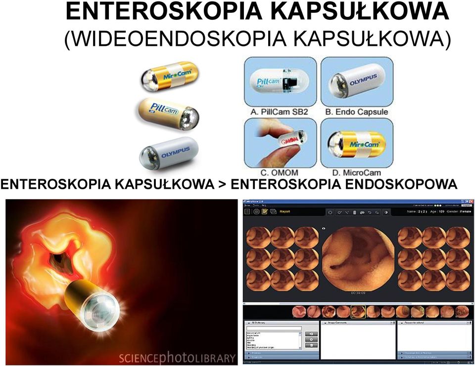 KAPSUŁKOWA)  >