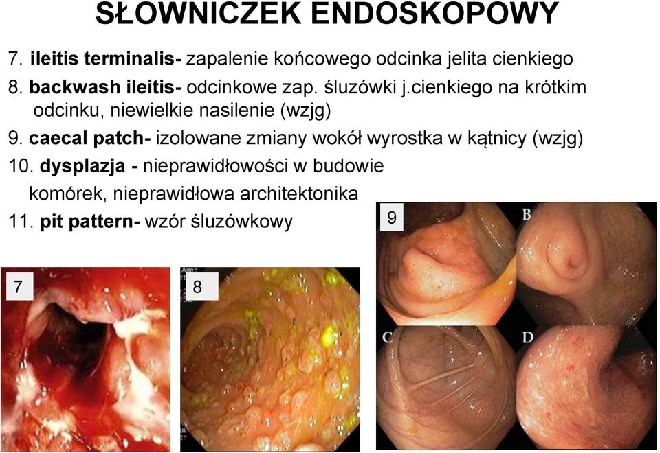 cienkiego na krótkim odcinku, niewielkie nasilenie (wzjg) 9.