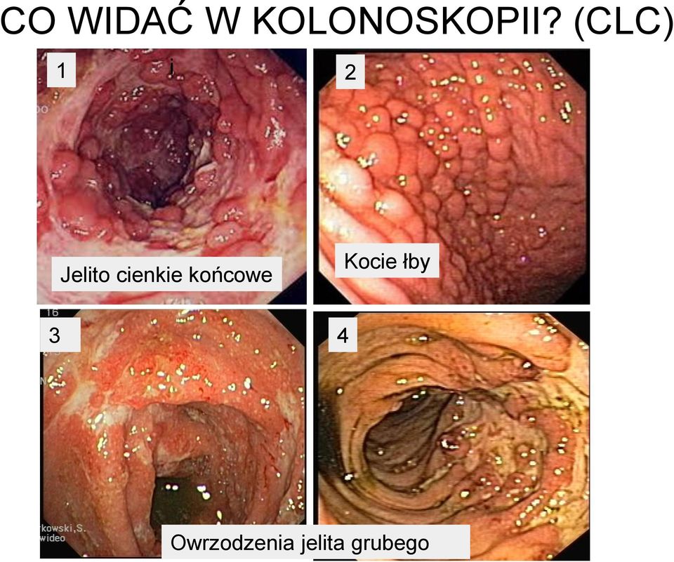 cienkie końcowe Kocie