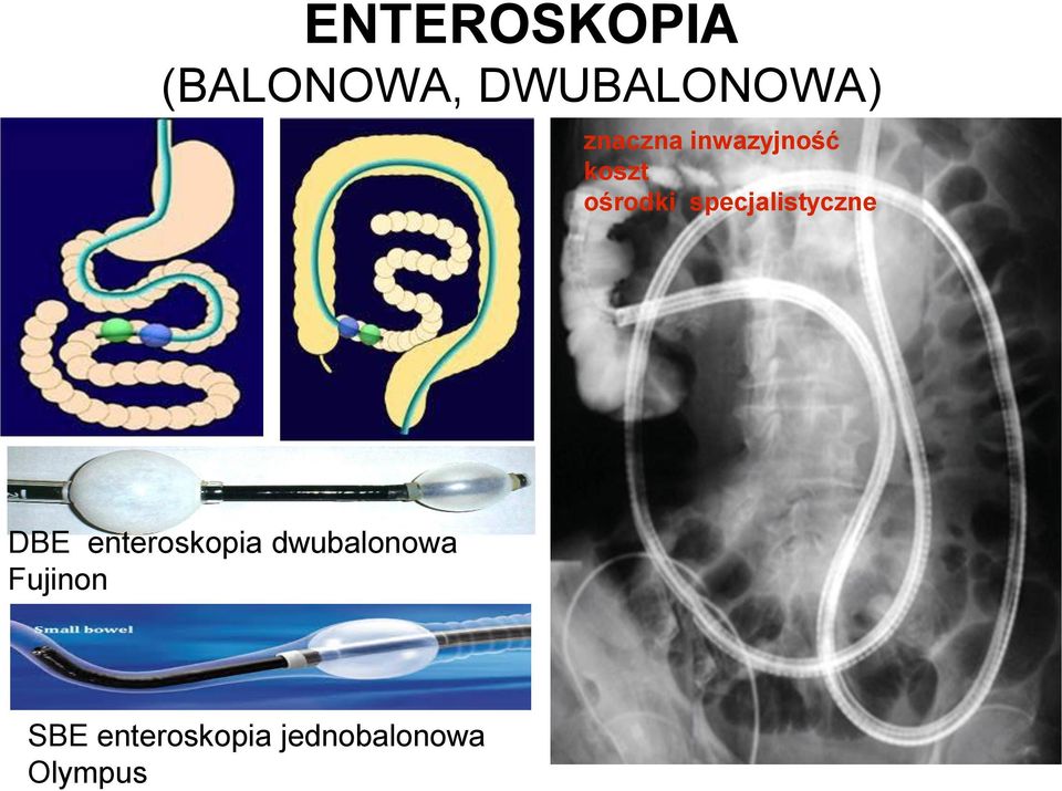specjalistyczne DBE enteroskopia