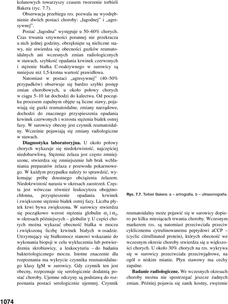 Czas trwania sztywności porannej nie przekracza u nich jednej godziny, obrzęknięte są nieliczne stawy, nie stwierdza się obecności guzków reumatoidalnych ani wczesnych zmian radiologicznych w