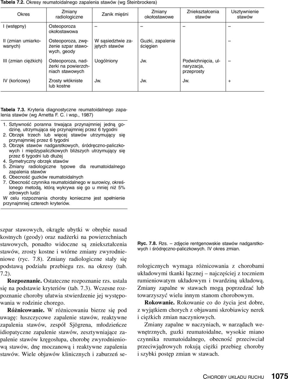 II (zmian umiarkowanych) Osteoporoza, zwężenie szpar stawowych, geody W sąsiedztwie zajętych stawów Guzki, zapalenie ścięgien III (zmian ciężkich) Osteoporoza, nadżerki na powierzchniach stawowych