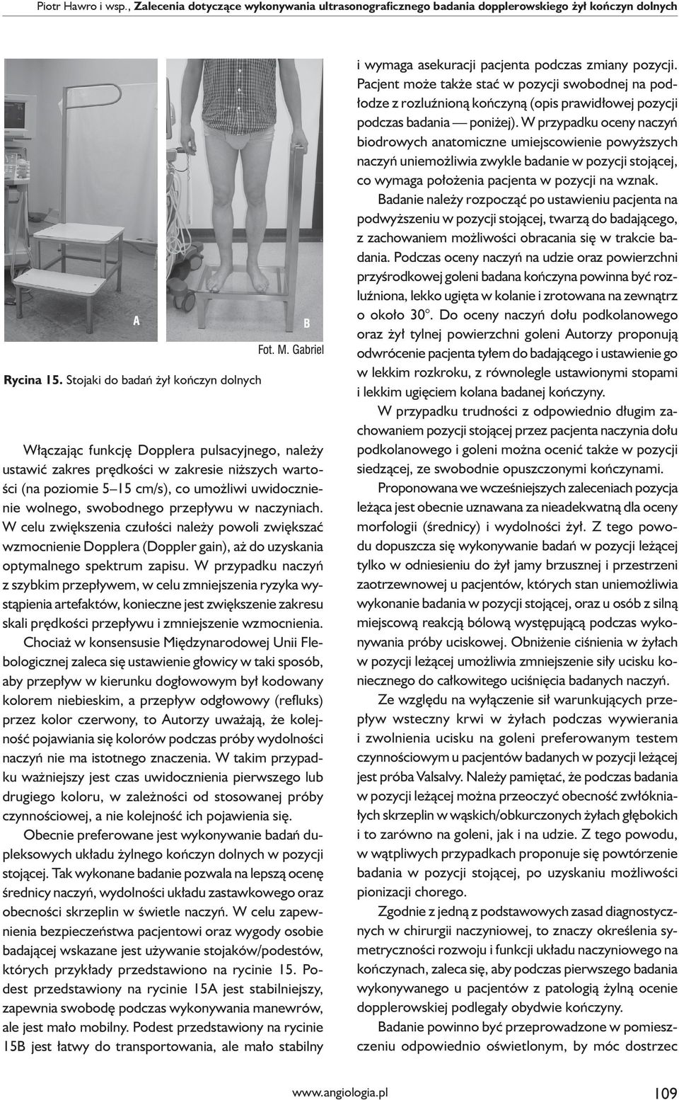 swobodnego przepływu w naczyniach. W celu zwiększenia czułości należy powoli zwiększać wzmocnienie Dopplera (Doppler gain), aż do uzyskania optymalnego spektrum zapisu.